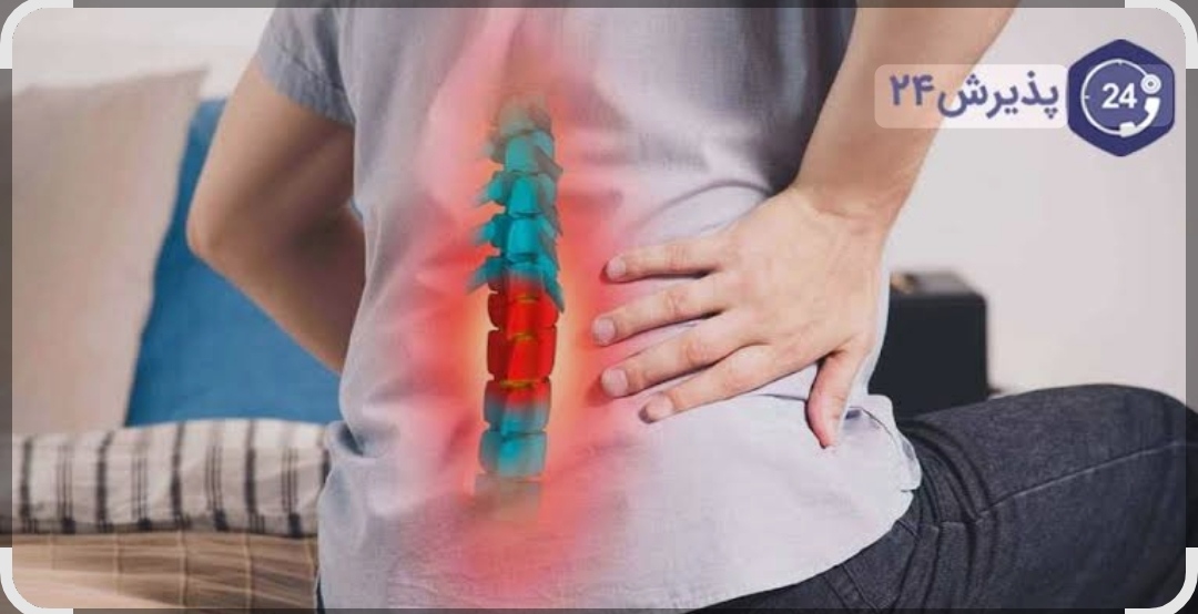 ژنتیک مهمترین علت دیسک کمر است